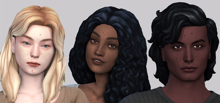 Acne Skin Detail Redux for TS4